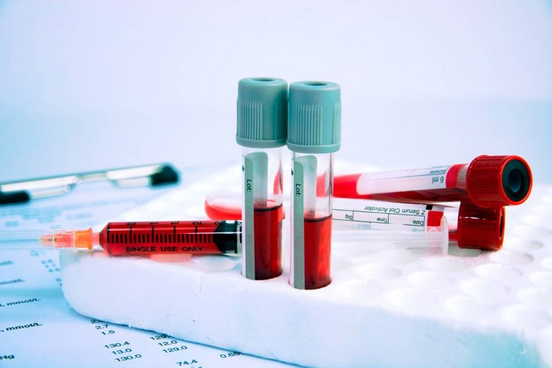 Новосибирск анализ крови на гормоны щитовидной железы thumbnail